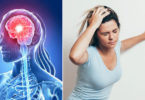 Serangan Stroke (Illustration - Shutterstock)