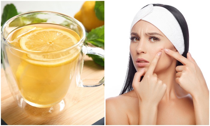 Air Lemon Menyembuhkan Jerawat