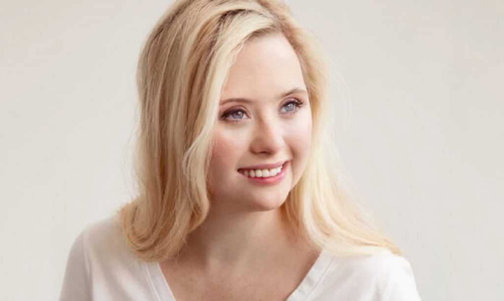 Grace Strobel, 24, menjadi model untuk kampanye SKINclusion dari Obagi. (Obagi via TheEpochTimes)
