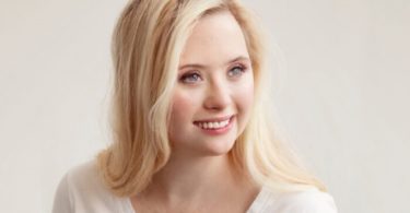 Grace Strobel, 24, menjadi model untuk kampanye SKINclusion dari Obagi. (Obagi via TheEpochTimes)