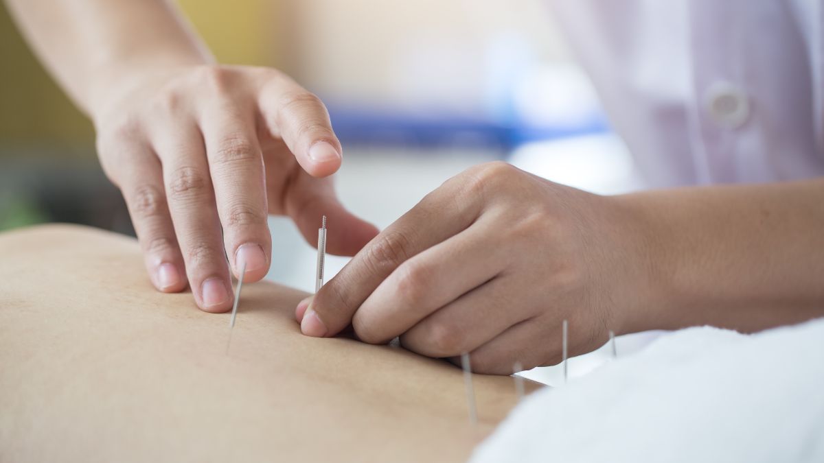 Akupunktur dan Pengobatan Tradisional Tiongkok untuk Mengobati Diabetes