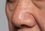 Pori-pori hidung