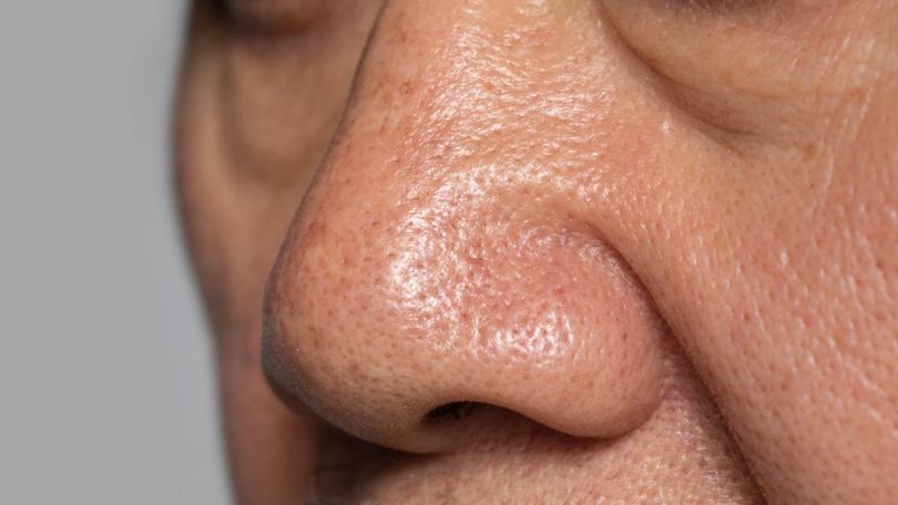 Pori-pori hidung